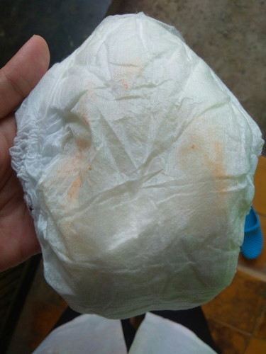 BABY KURANG CAIRAN KAH?