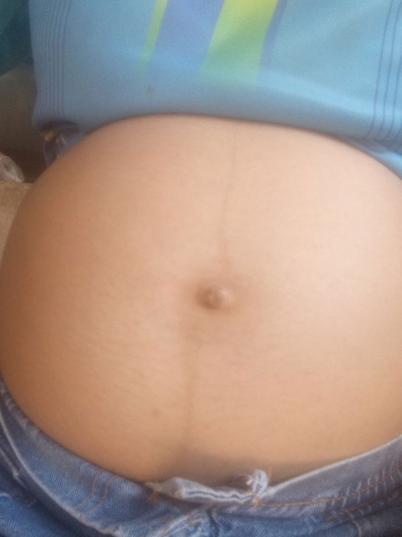 ท้องแบบนี้หญิงหรือชายค่ะ