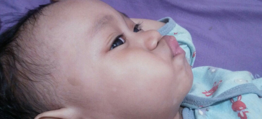 bintik putih
