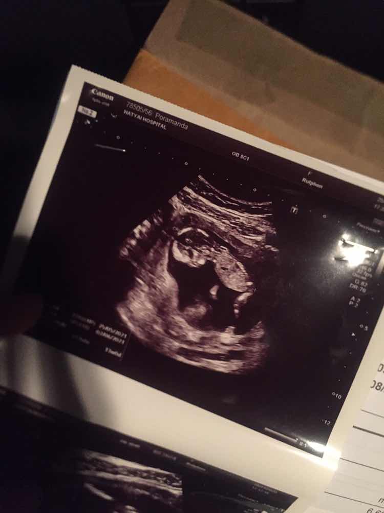 ชานม profile icon