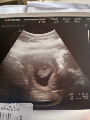 Atchara Inmueunwai Ploy profile icon