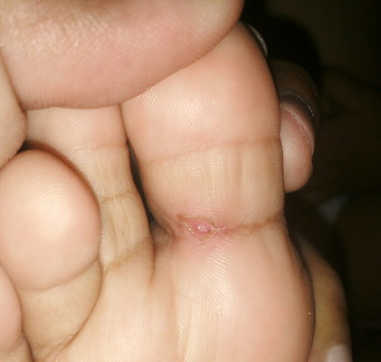 telapak kaki