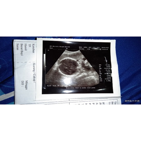 30 weeks