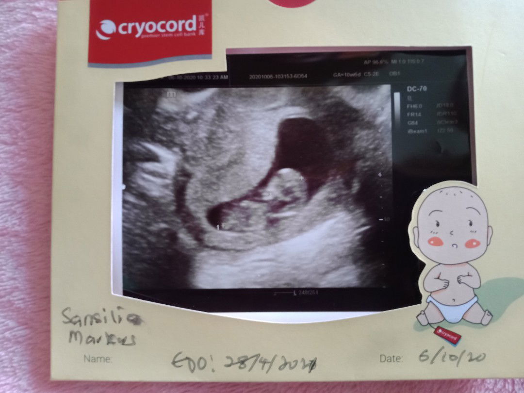 Sansilia Markus profile icon