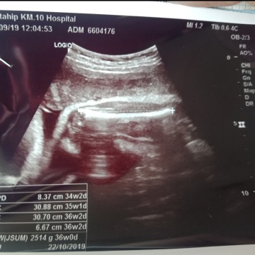 แม่ช่วยดูหน่อยจ้า