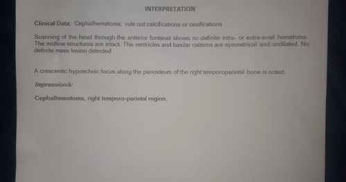 Bukol sa ulo o cephalohematoma
Ultrasound result