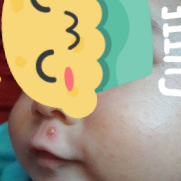 bintik merah