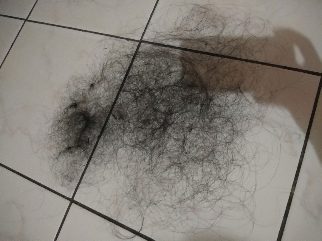 pngen rambut kmbali normal