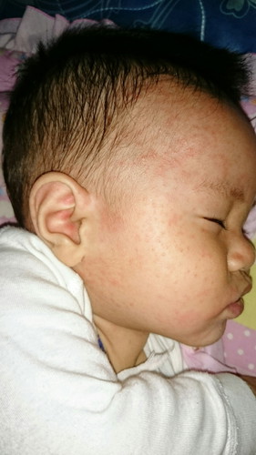 ลูก6เดือนตัวเย็นแต่เหงื่อออก