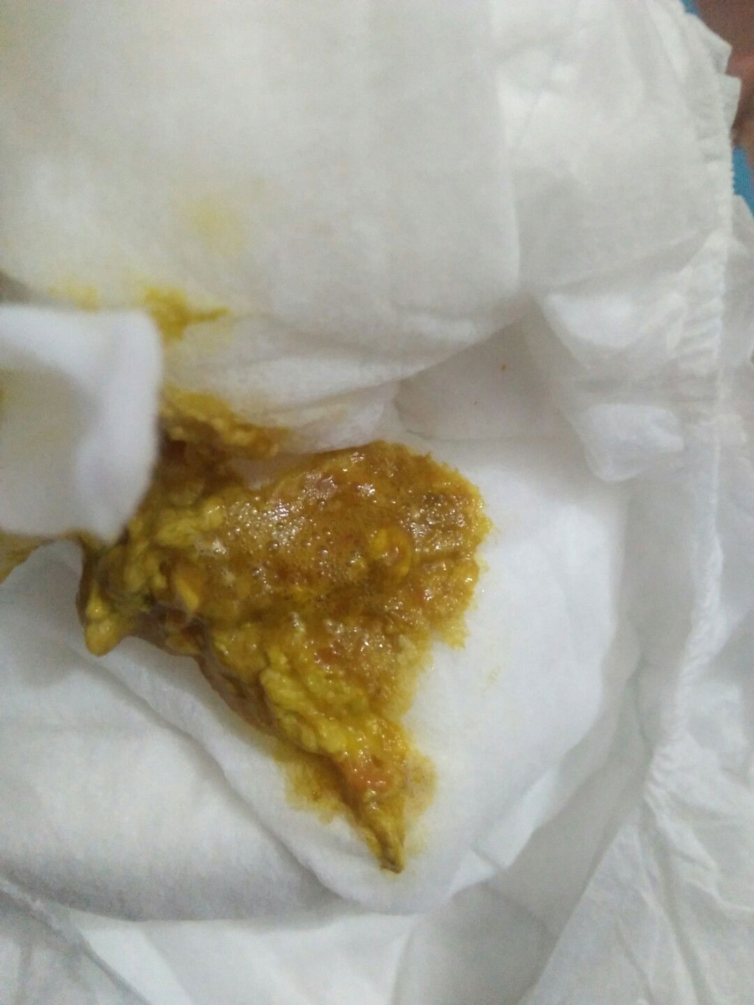 klw jijik jgn d buka ya bunda