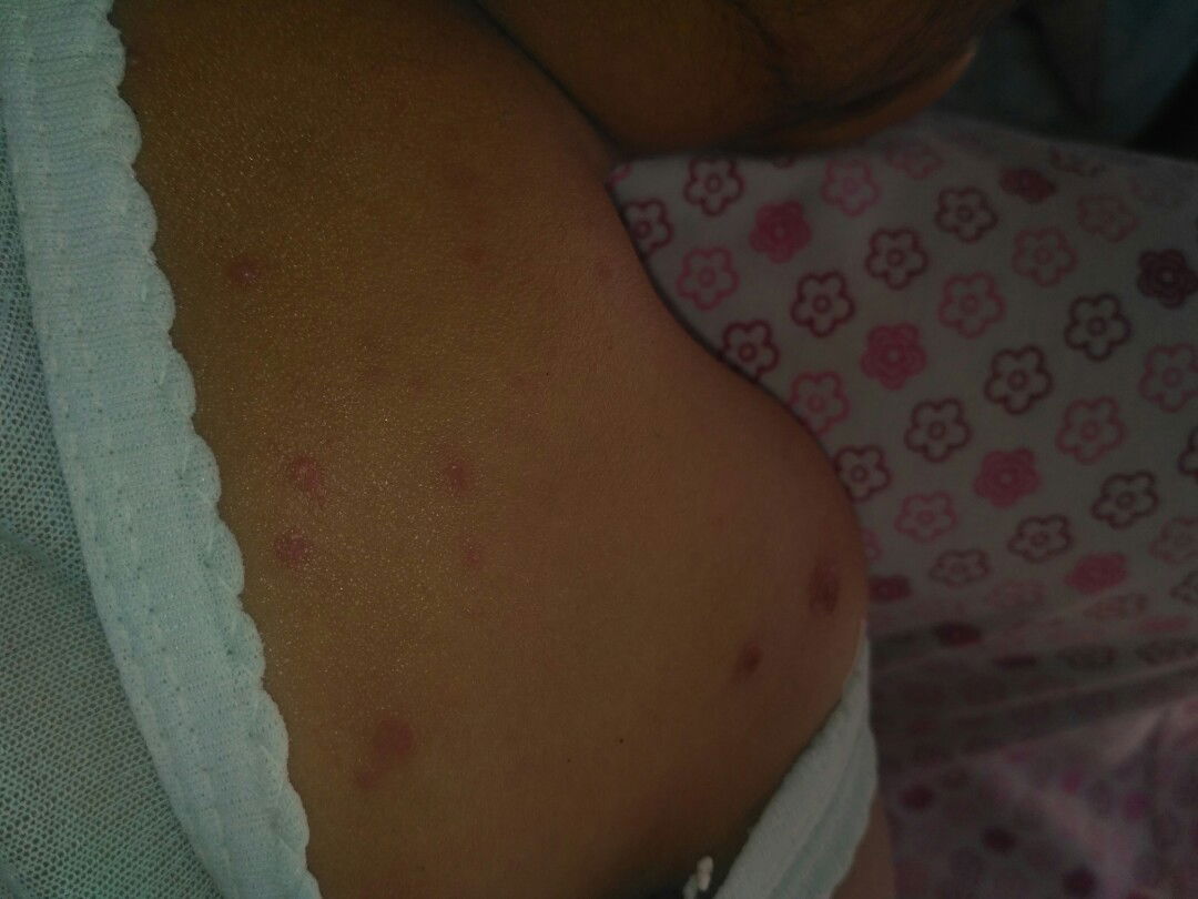 ada yang pernah mengalami seperti inikah bun bayinya?