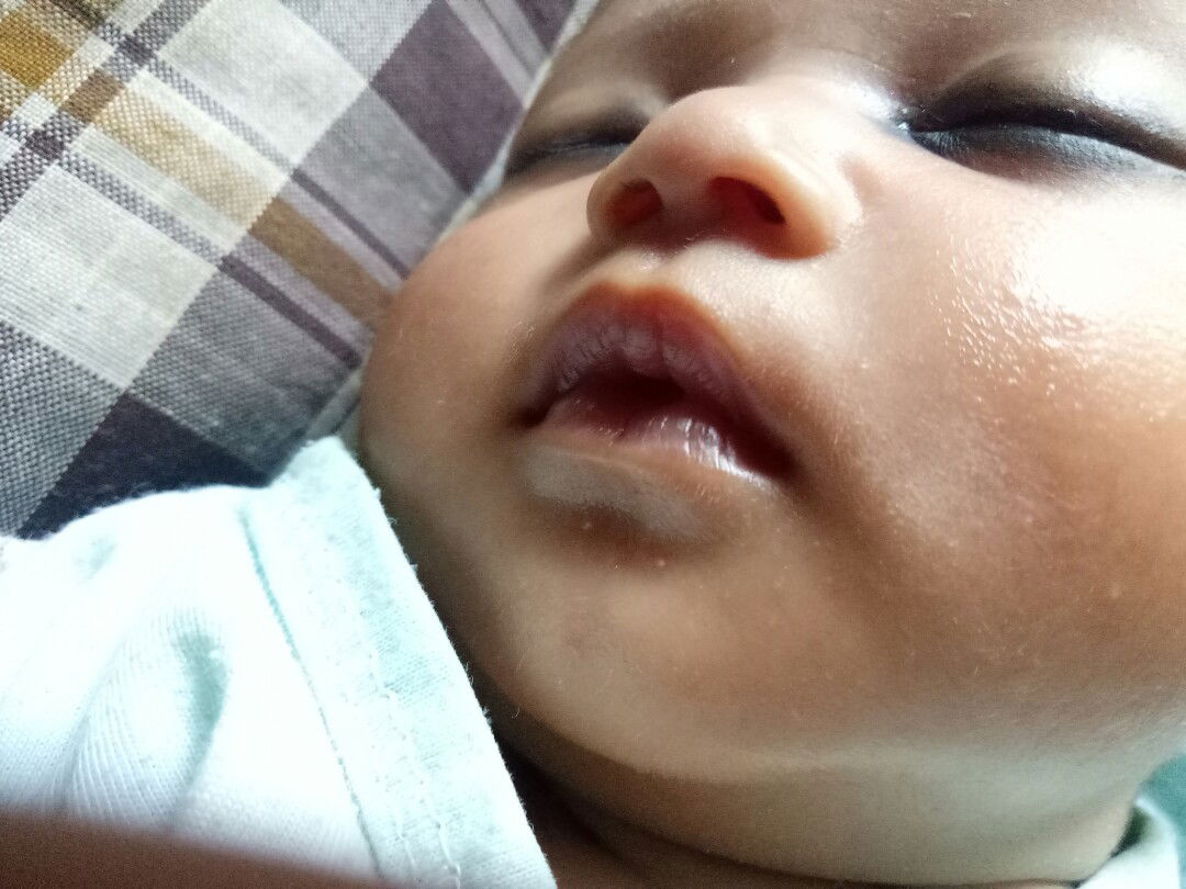 bintik putih daerah dagu