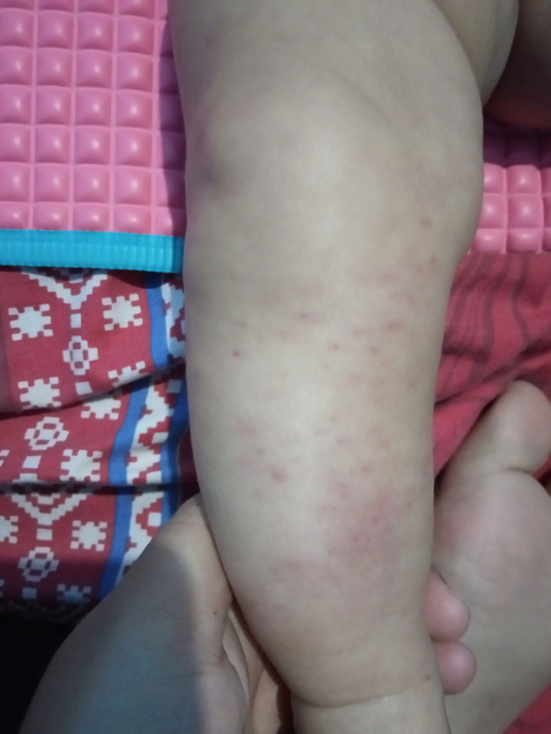 Bintik merah di kaki