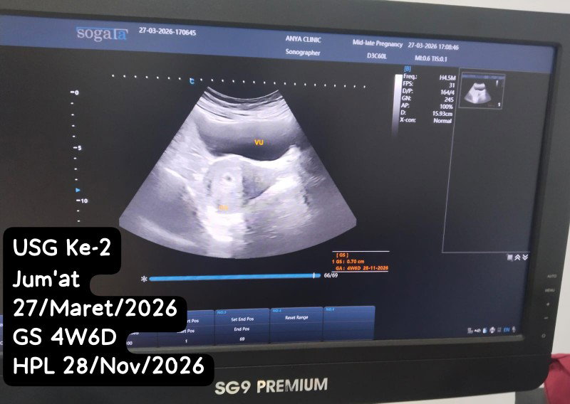 Khurin Aini profile icon