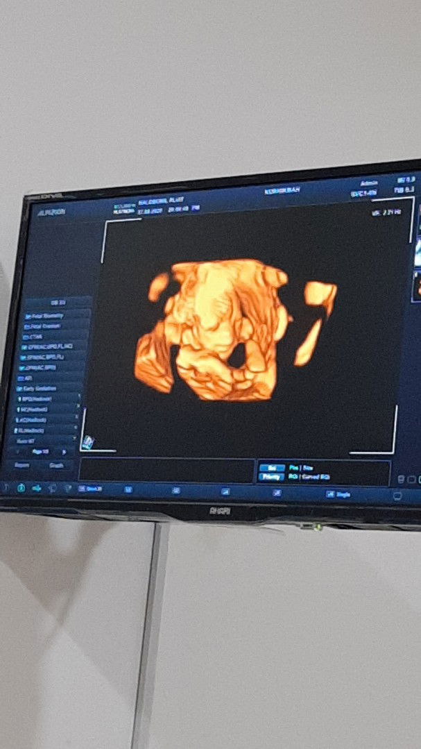 Hikmah Syam Talundru profile icon