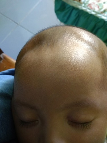 Kepala peyang