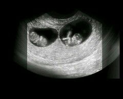 fithrie marchella profile icon