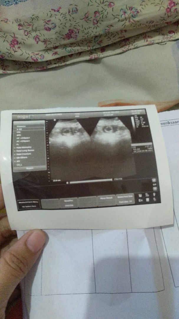 Aprillio putra Ismawan profile icon