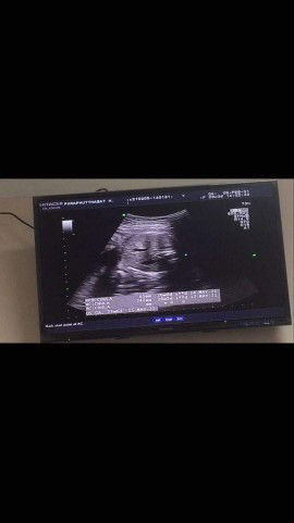 มิ้ว สุพัตรา profile icon