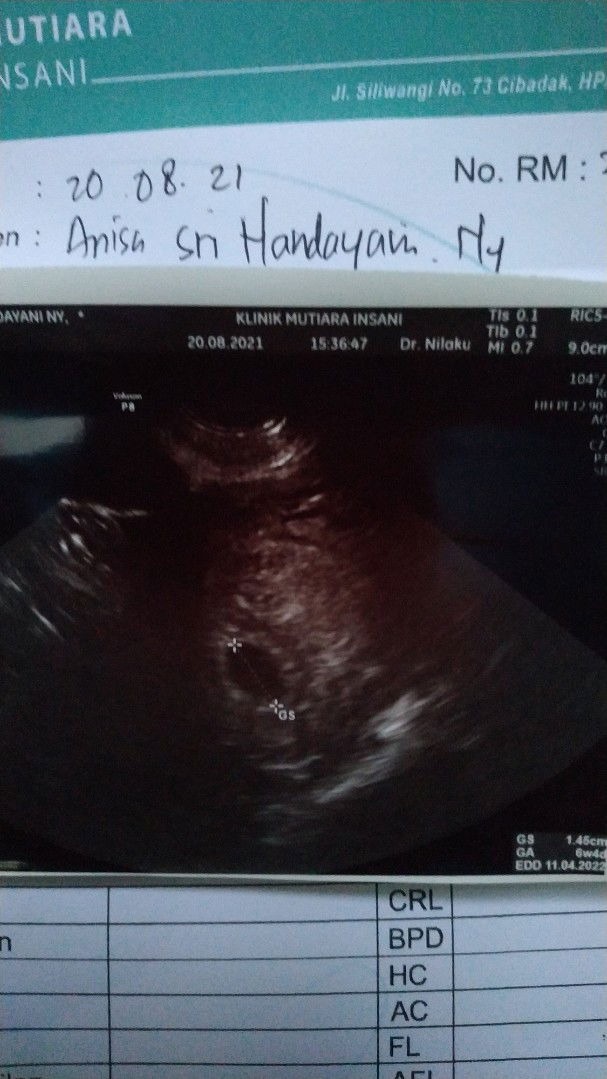 Anisa Sri Handayani profile icon