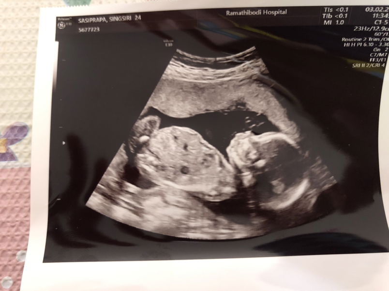 sasiprapa singsiri profile icon