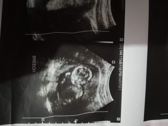 mj Salayog profile icon