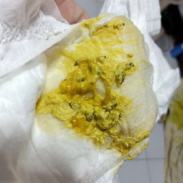 สีอึ ทารก