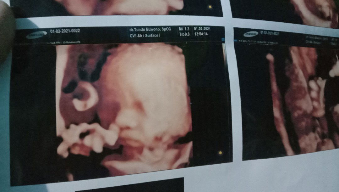 septa Damayanti profile icon