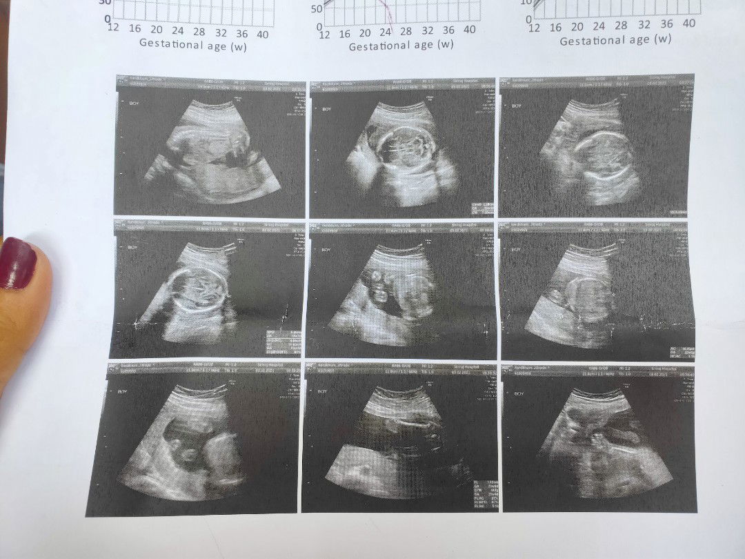 บอย แสงเพร็ช profile icon