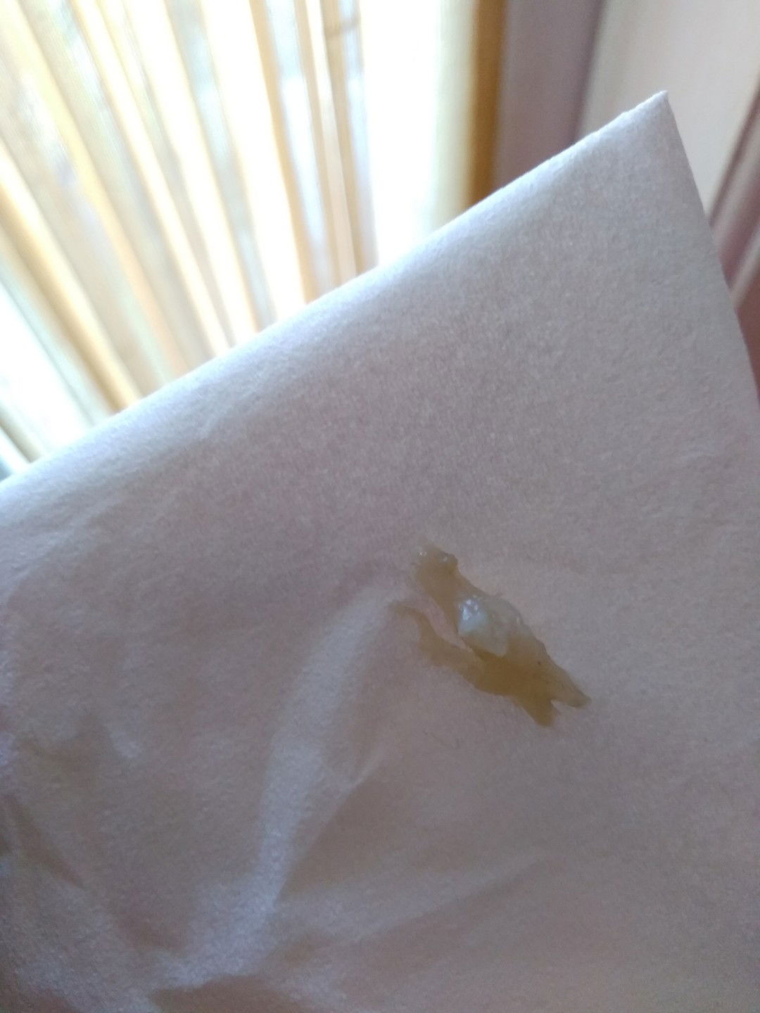 maaf agak jorok , yg jijian jangan di liat yah bun