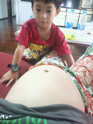 ไม่มีเส้นดำกลางท้อง