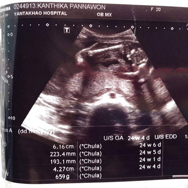 กัณฐิกา แป้นนวล profile icon