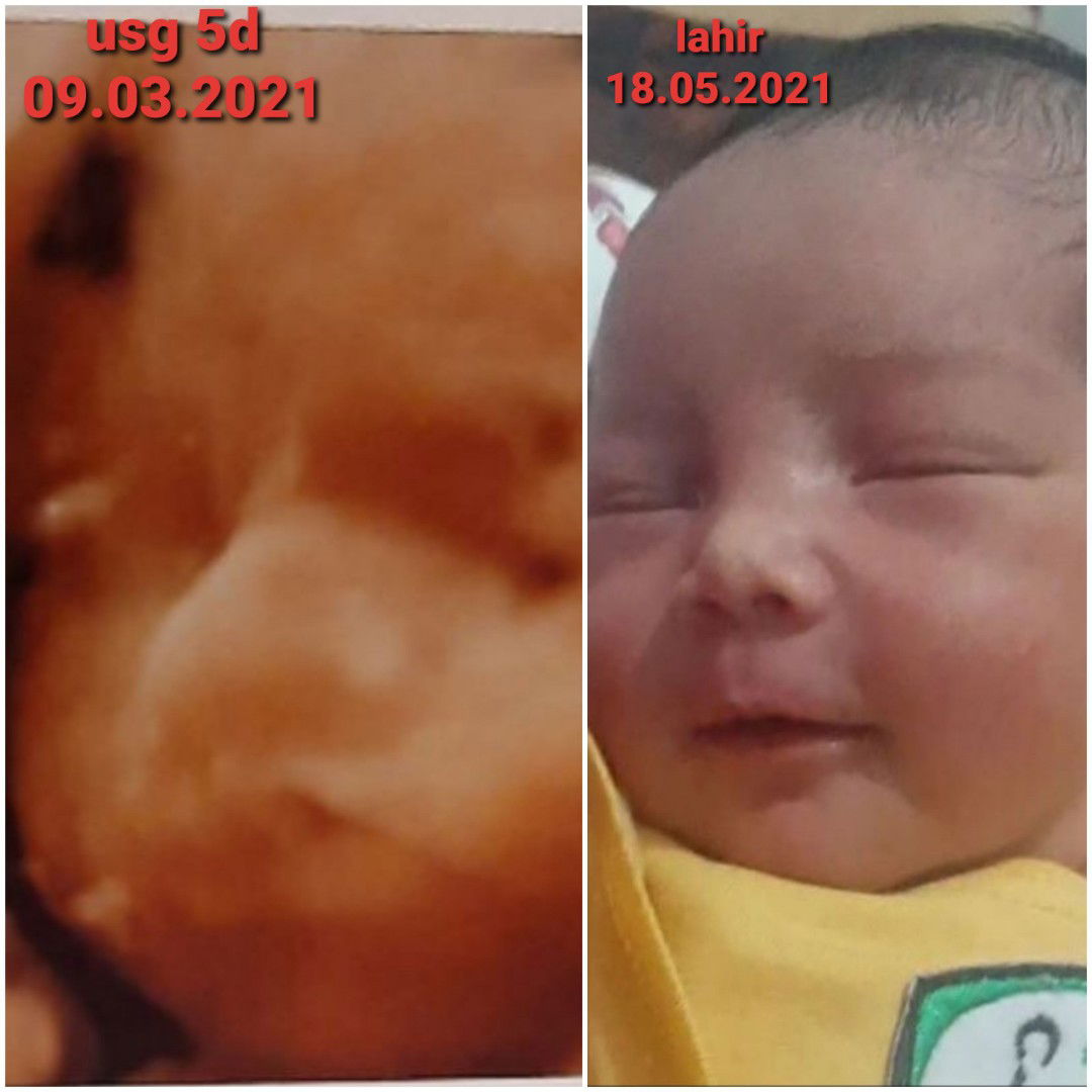 Alhamdulillah Launching Baby Boy