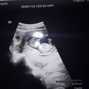 Noviyanti Azharoh Ferti profile icon