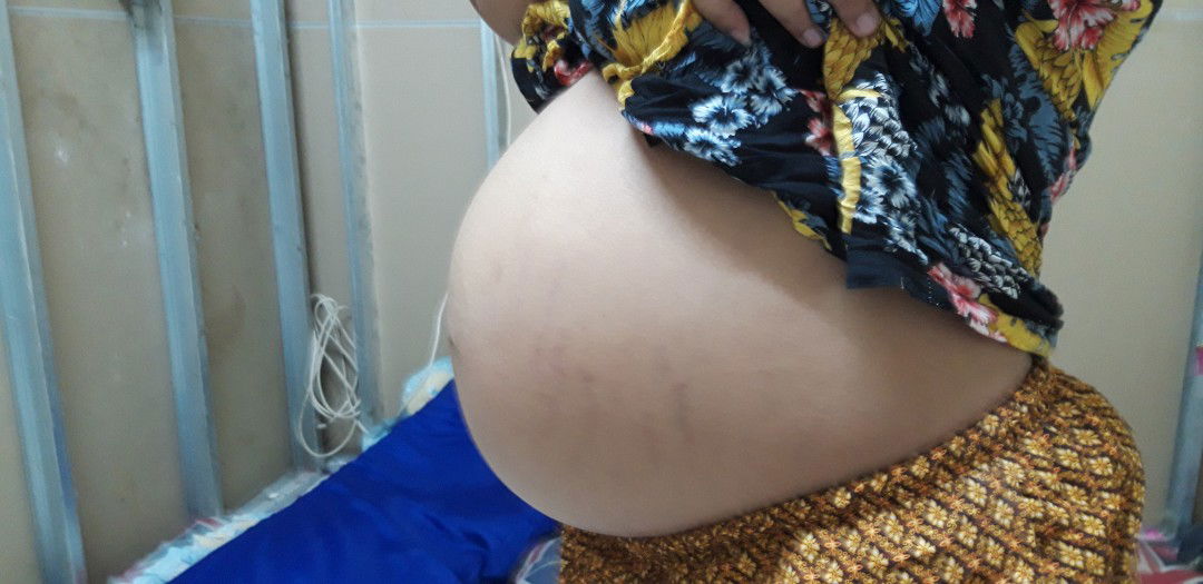 แบบนี้ท้องลดหรือยังคะ