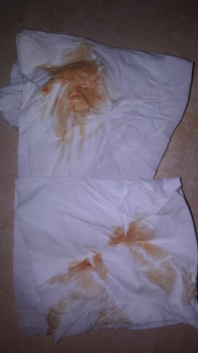 sore bunda mau tanya nih,saya lagi hamil 3 minggu ada yang ngefelek setiap hari kaya saya ngk ya