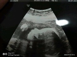 26 week คะ ?