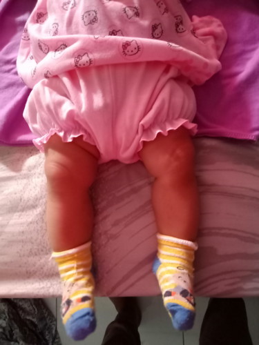 kaki bayi 3bulan