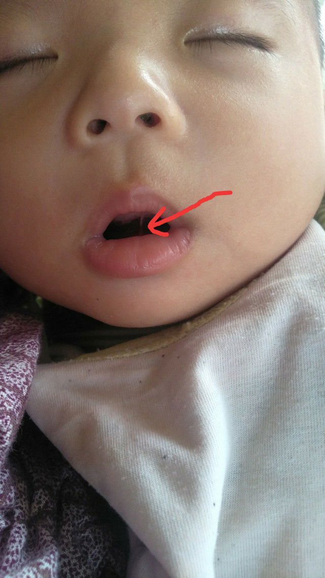 apa bisa menyatu lagi