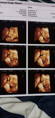 ซาวด์ 4 มิติ