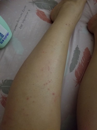 ปรึกษาค่ะ แอบกังวลแต่ไม่อยากไปรพ.