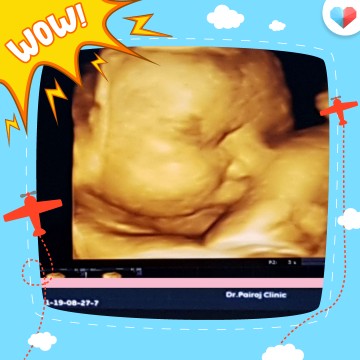 36w3d
