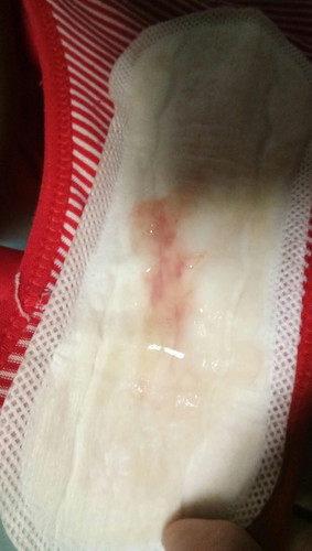 ใช่มูกเลือดรึป่าวค่ะ 39w