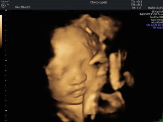 เหม่ง เอ๋ออ'อ profile icon