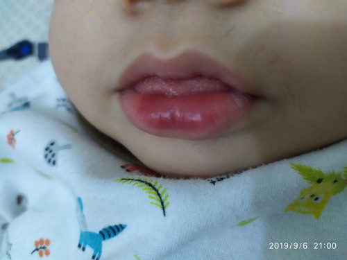 Bibir biru