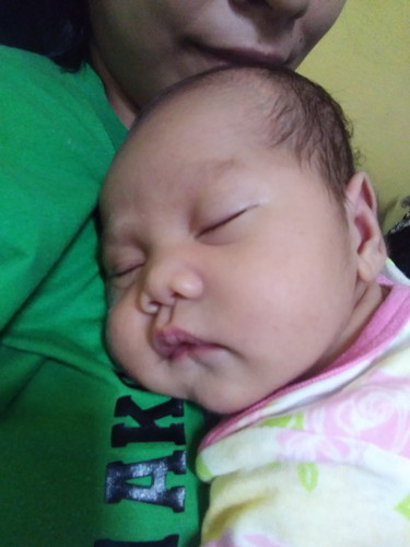 My pure breastfeed baby?