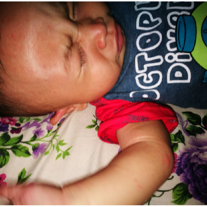 Bintik merah pada anak..