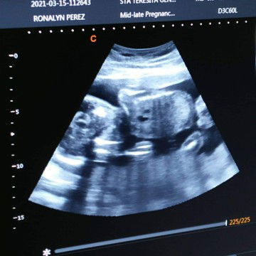 Rona Perez profile icon