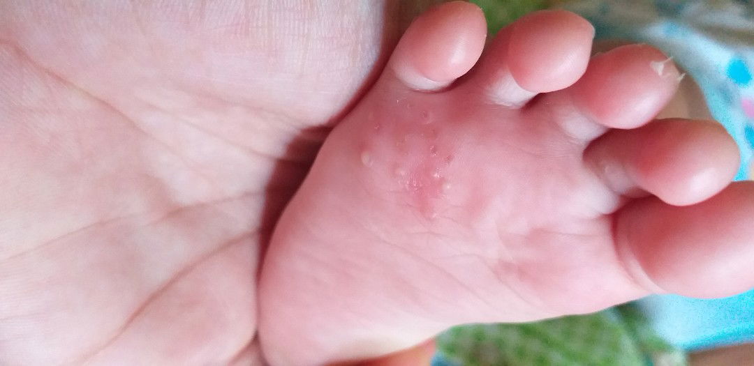 Harus  Pake apa lagi?