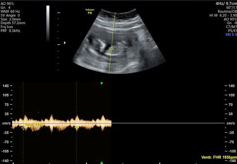 Risti Annisa profile icon